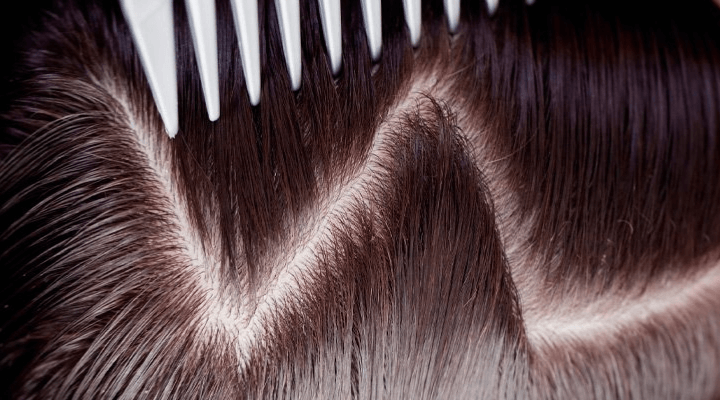 como cuidar do couro cabeludo