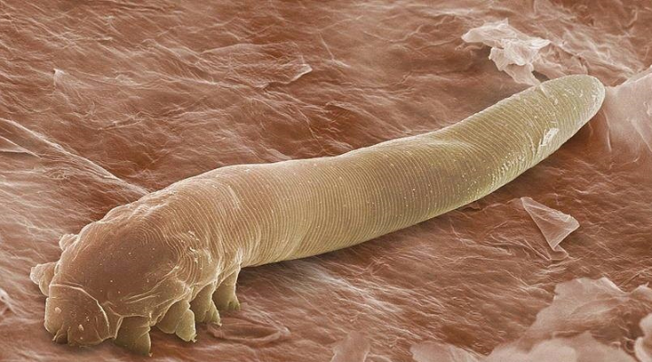 Demodex Folliculorum.