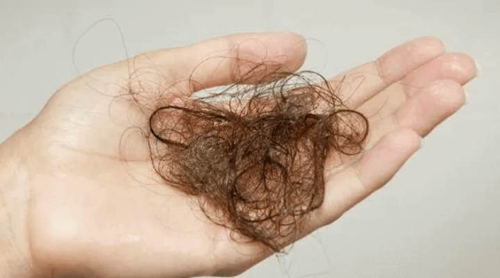 como acabar com a queda de cabelo